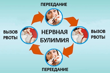Лечение булимии в Каргаполье